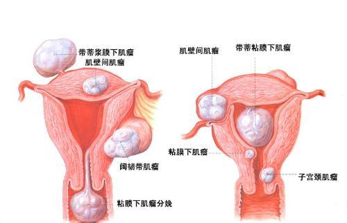 月经量少导致的危害