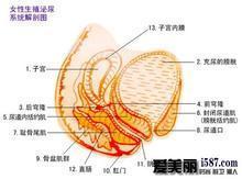 十类易感染附件炎的女性